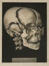 JEAN - MARC BOURGERY, "Traité complet de l’anatomie de l’ho