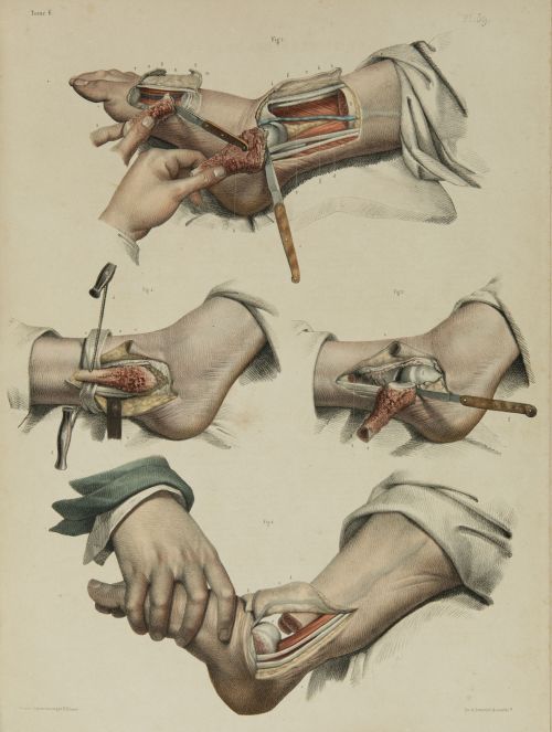 JEAN - MARC BOURGERY, "Traité complet de l’anatomie de l’ho